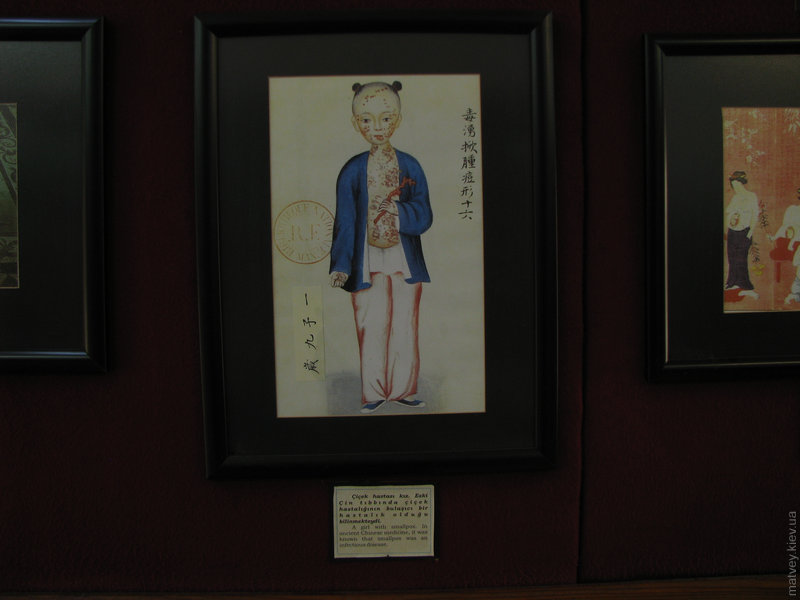 Малюнок: дівчинка, хвора на вітрянку. Музей лікарні Беязита другого. Едірне, Туреччина